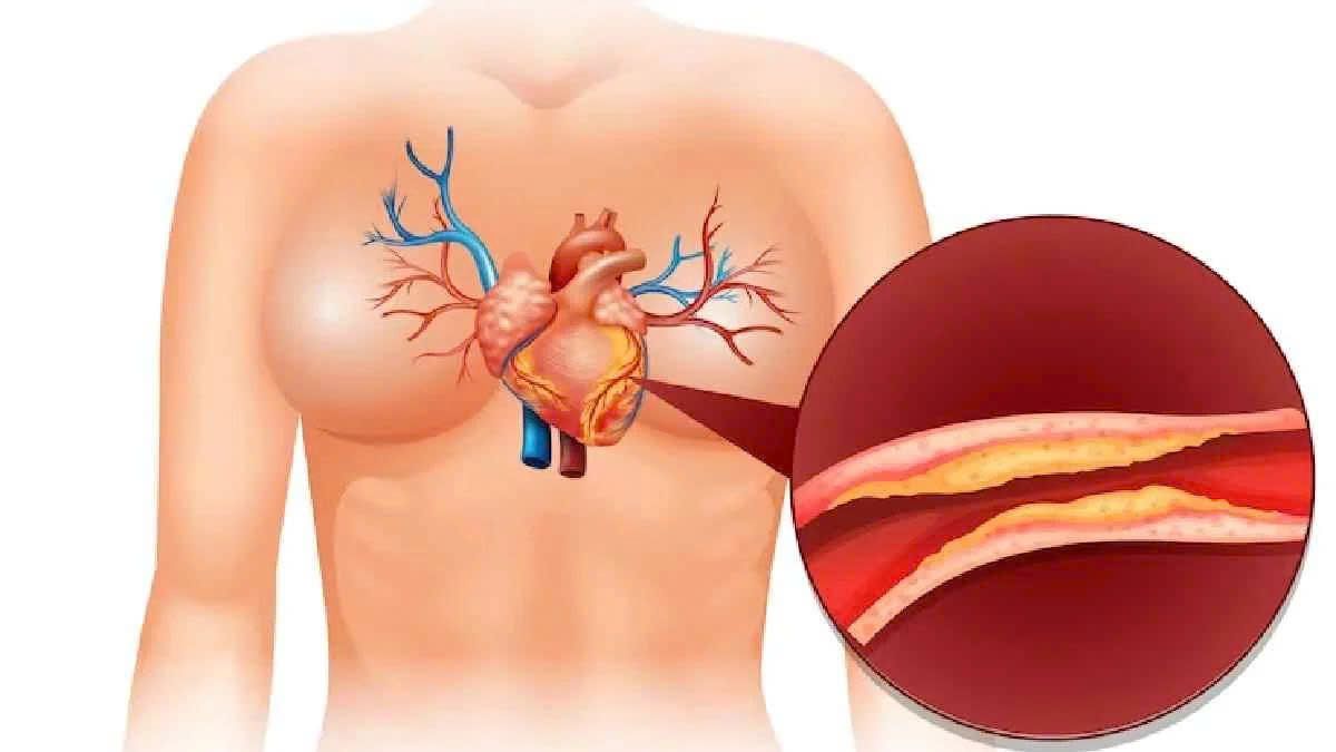 Inorganic calcium may contribute to calcium buildup and plaque formation in blood vessels.