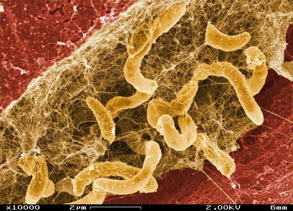 persistent-recurrent-candida-infections-causes-and-effective-management-strategies 1