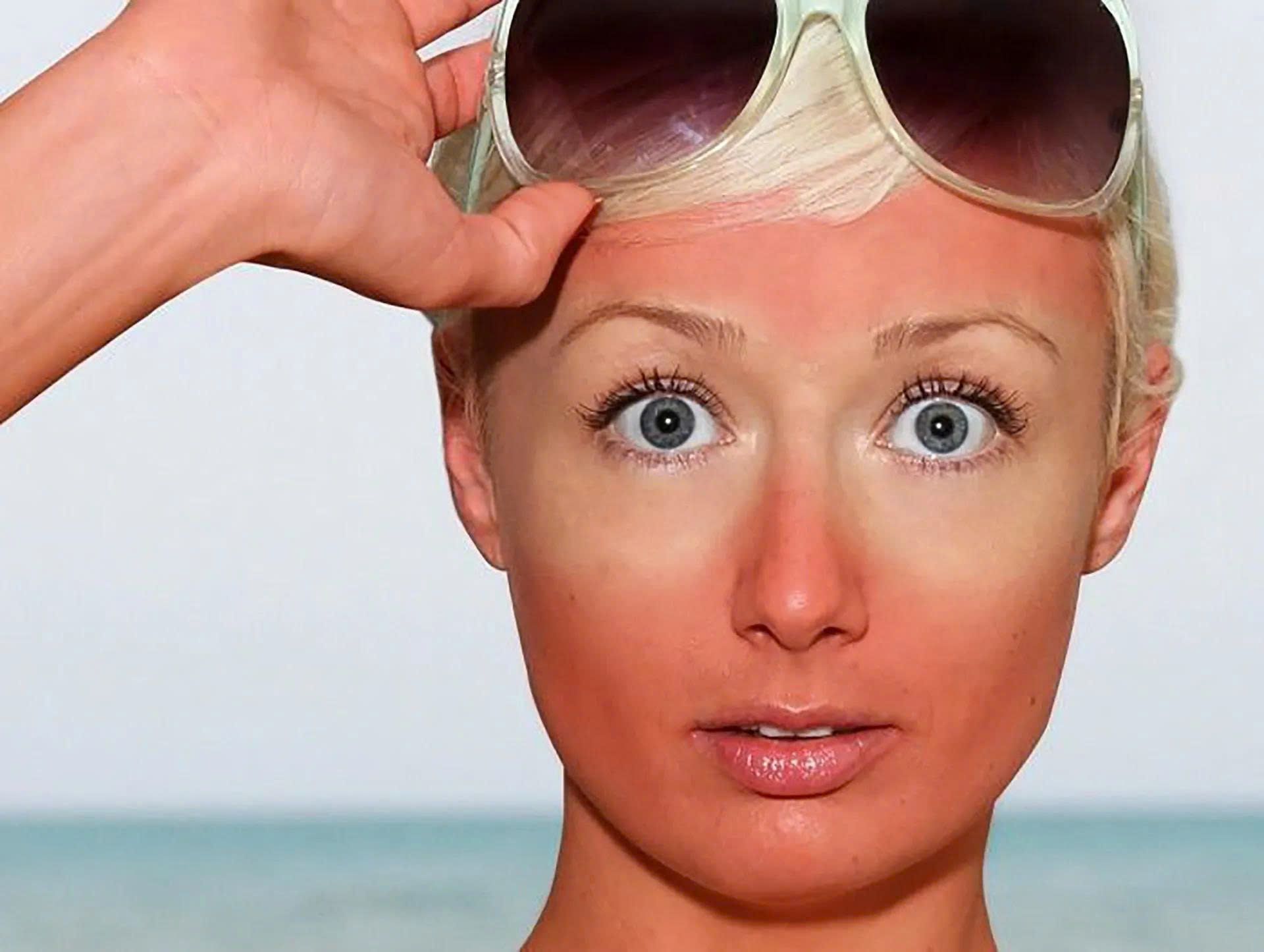 3 causes of sensitive skin & a science-backed recovery routine from Nzheal 2 3 causes of sensitive skin & a science-backed recovery routine from Nzheal 7
