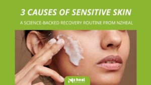 3 causes of sensitive skin & a science-backed recovery routine from Nzheal